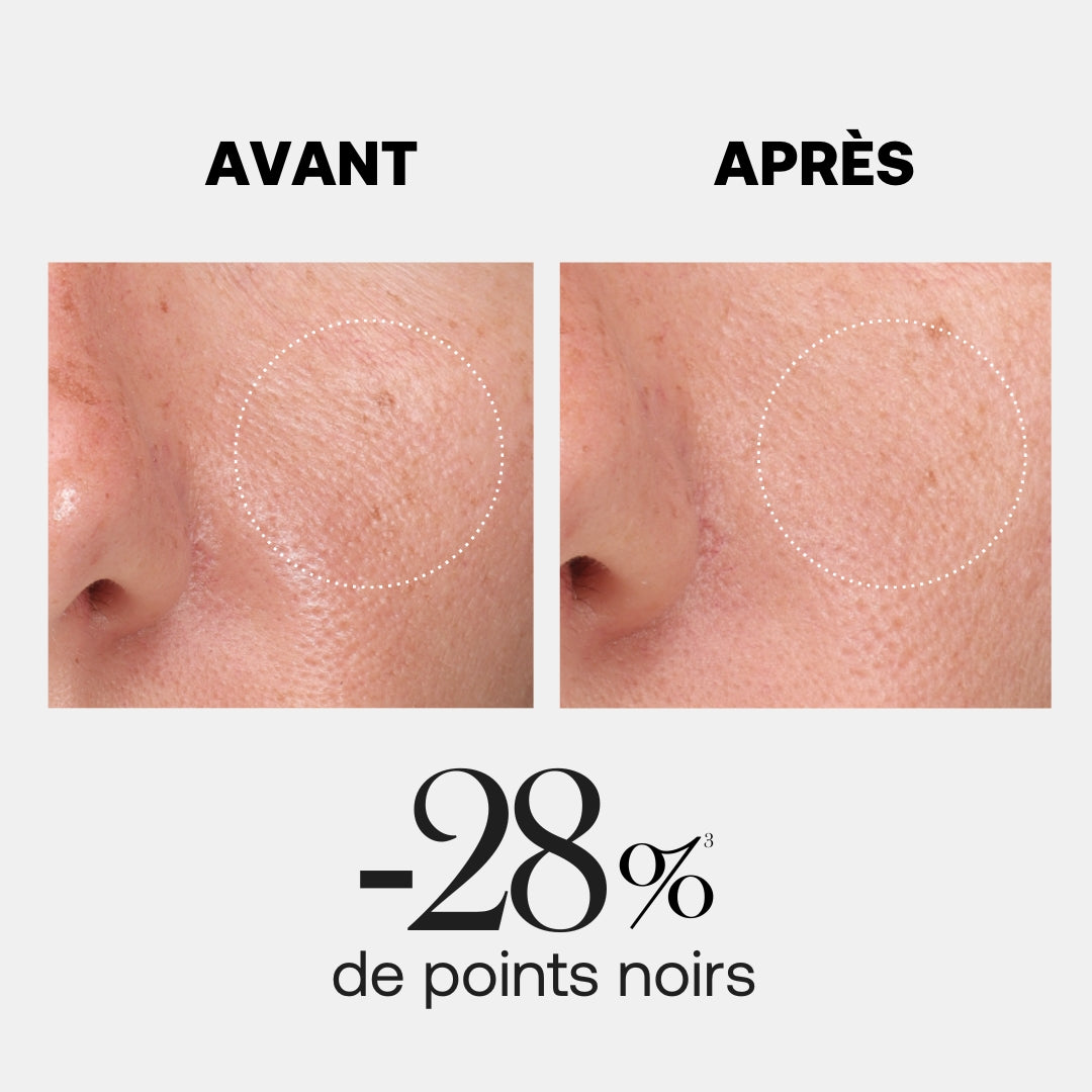 HYALURX-BOOST GEL-EN-CELULOSA EXFOLIANTE