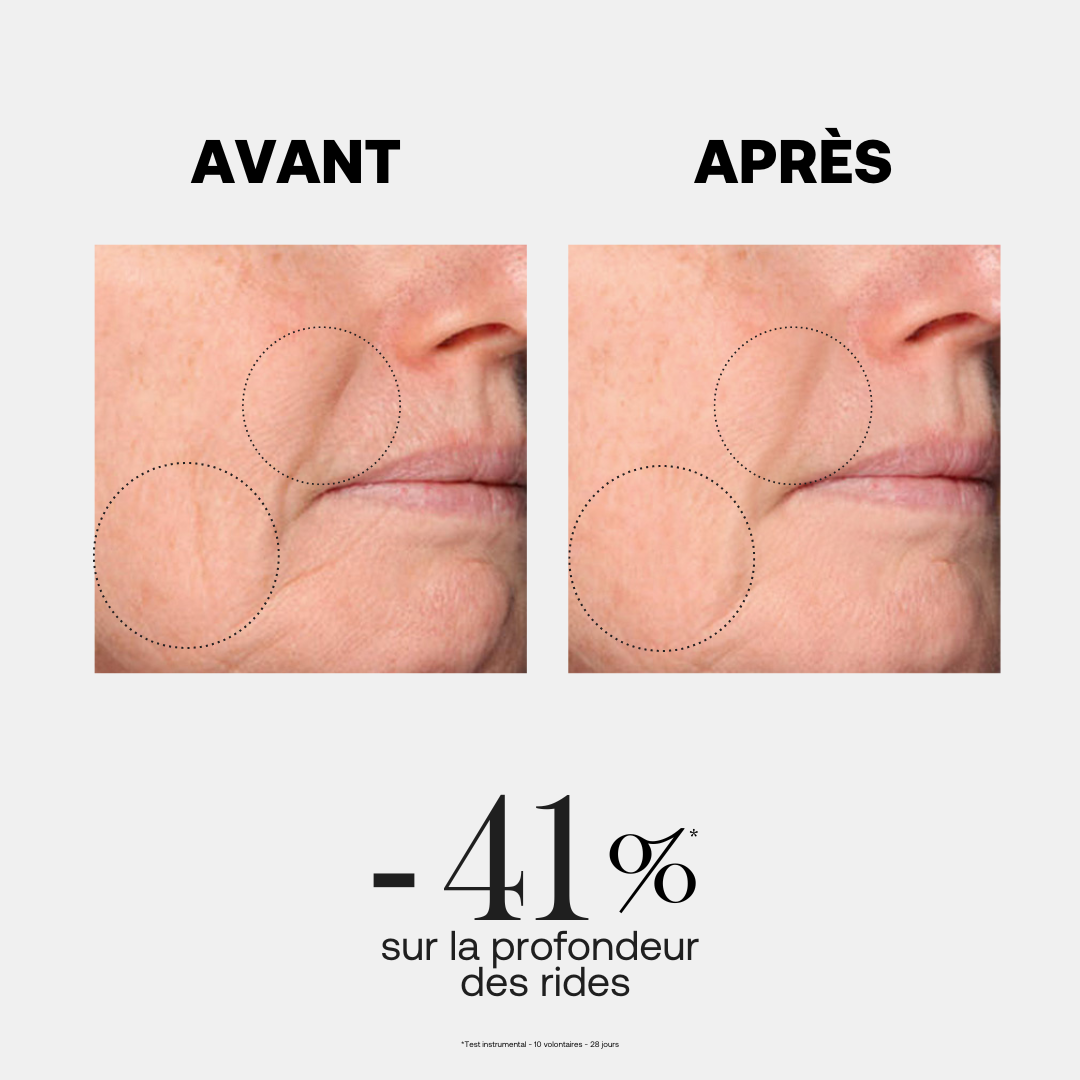 Line Killer Rich Crème 20ml