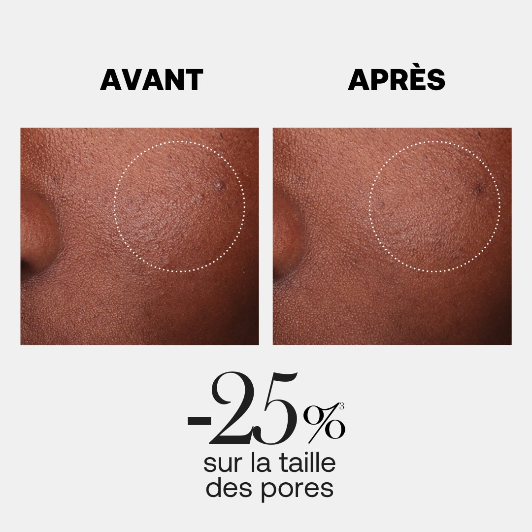 HYALURX-BOOST SANFTE REINIGUNGSLOTION