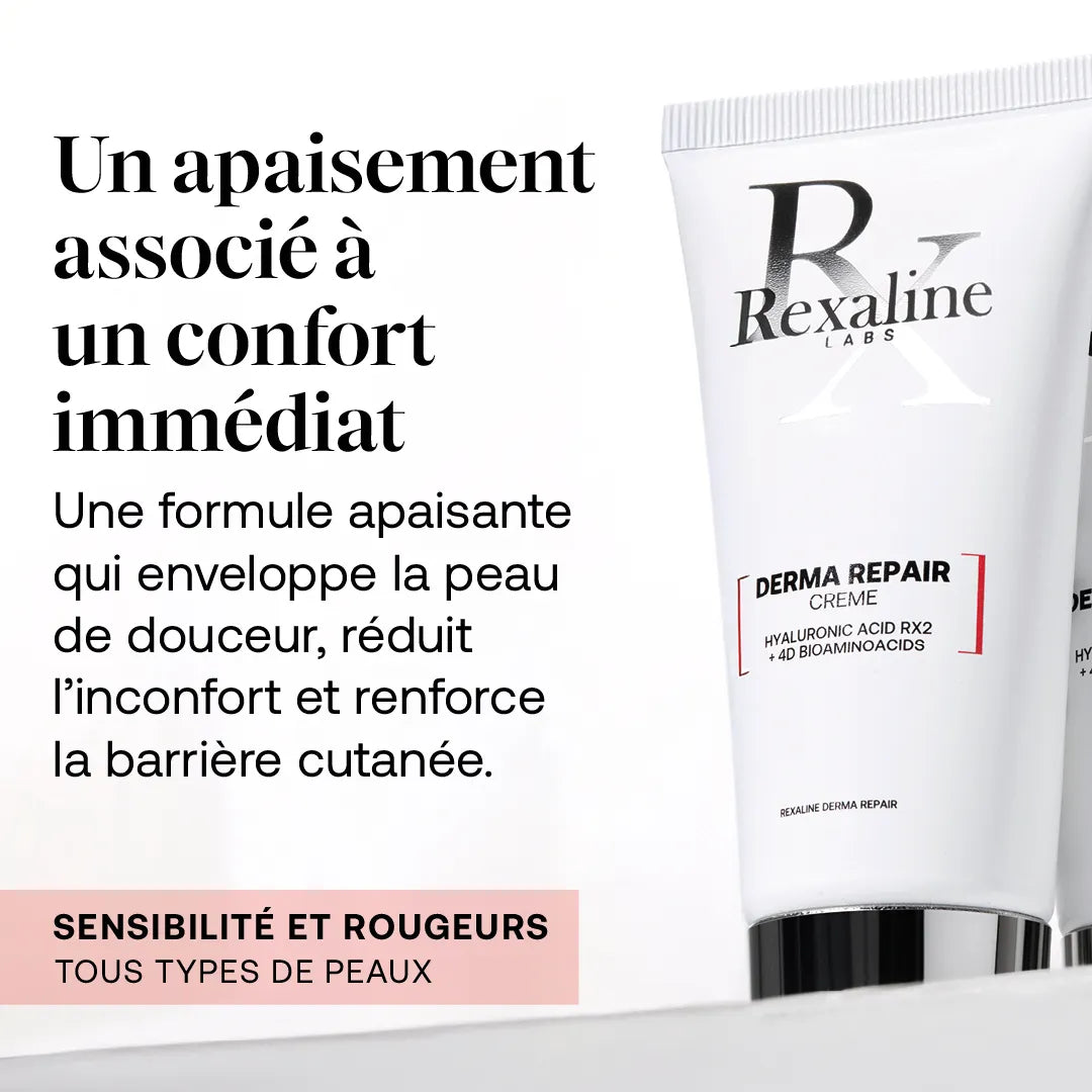 L'ESSENTIEL RX EN 4 ETAPES