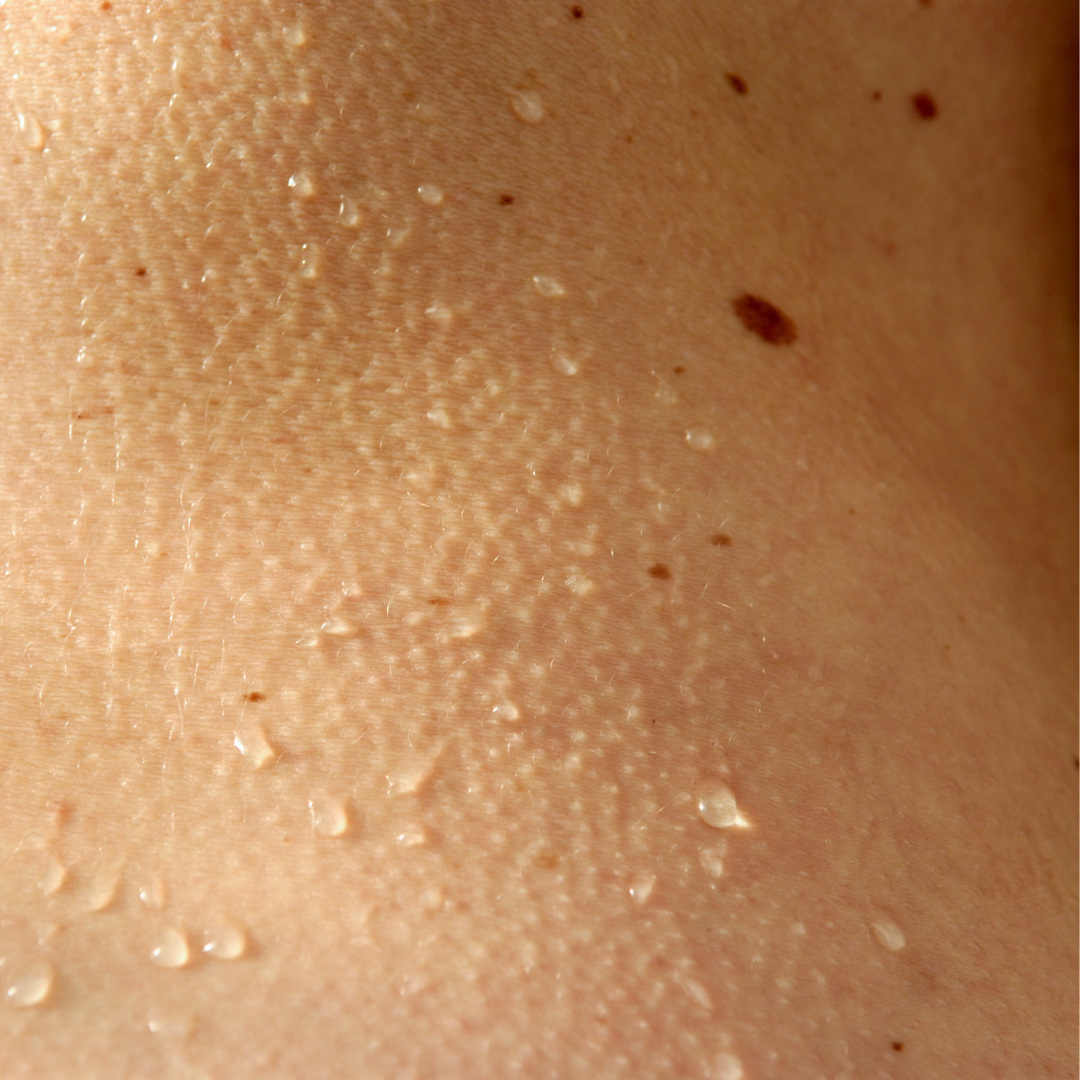 L'exposition solaire et les grains de beauté : tout ce que vous devez savoir pour protéger votre peau