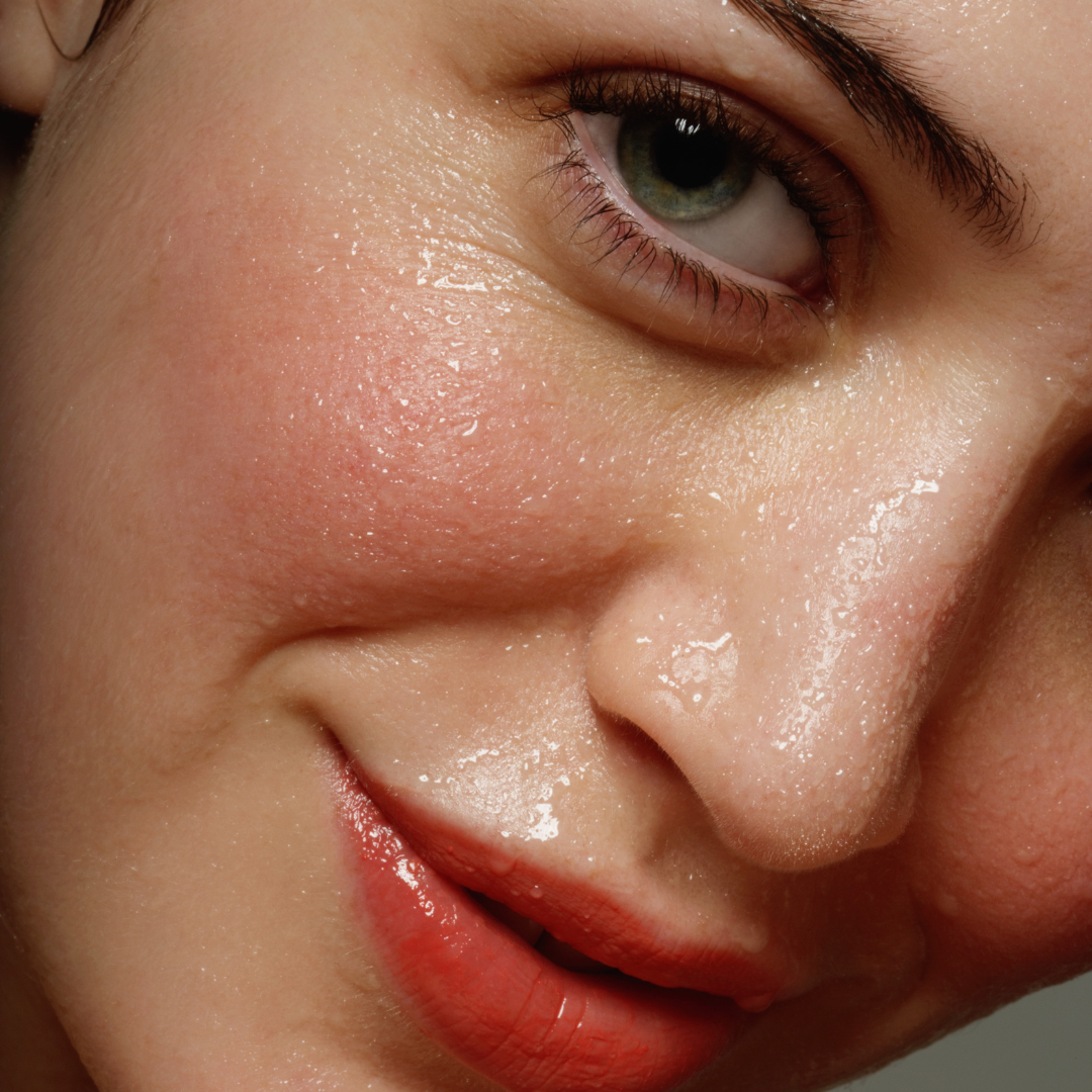 acide hyaluronique peau visage