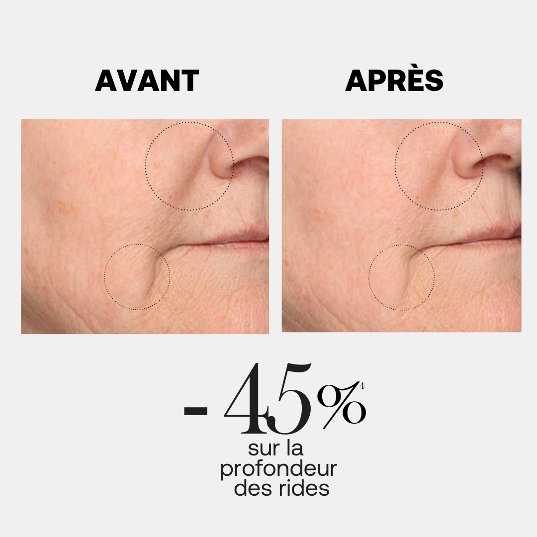 SERUM FIRMANTE ANTI-LÍNEAS